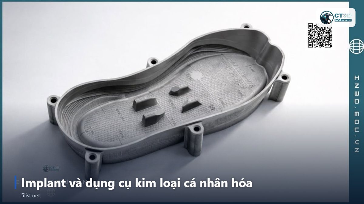 Implant và dụng cụ kim loại cá nhân hóa – Top 5 ứng dụng in 3D trong y tế và nha khoa nổi bật